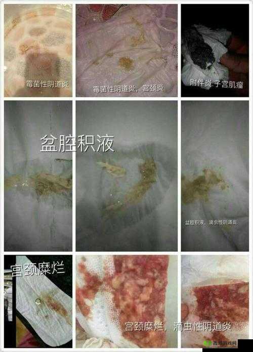 排阴毒奇人：老中医用嘴吸出女性下体毒素